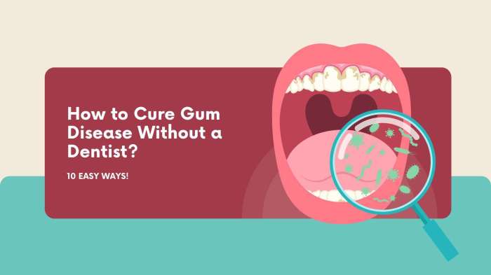 Gum disease remedies credit